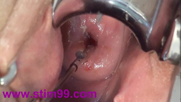 Cervix Fucking Play Deep Japanese Asian – å­å®®é ¸éƒ¨ã‚¯ã‚½